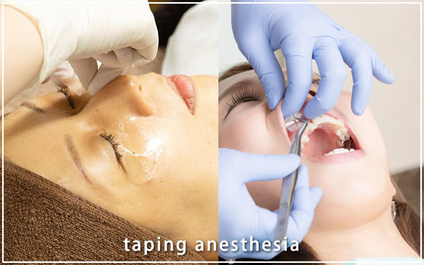 テープ麻酔