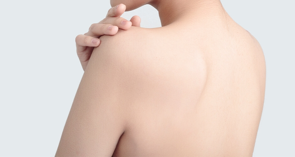 ワキガ・多汗症