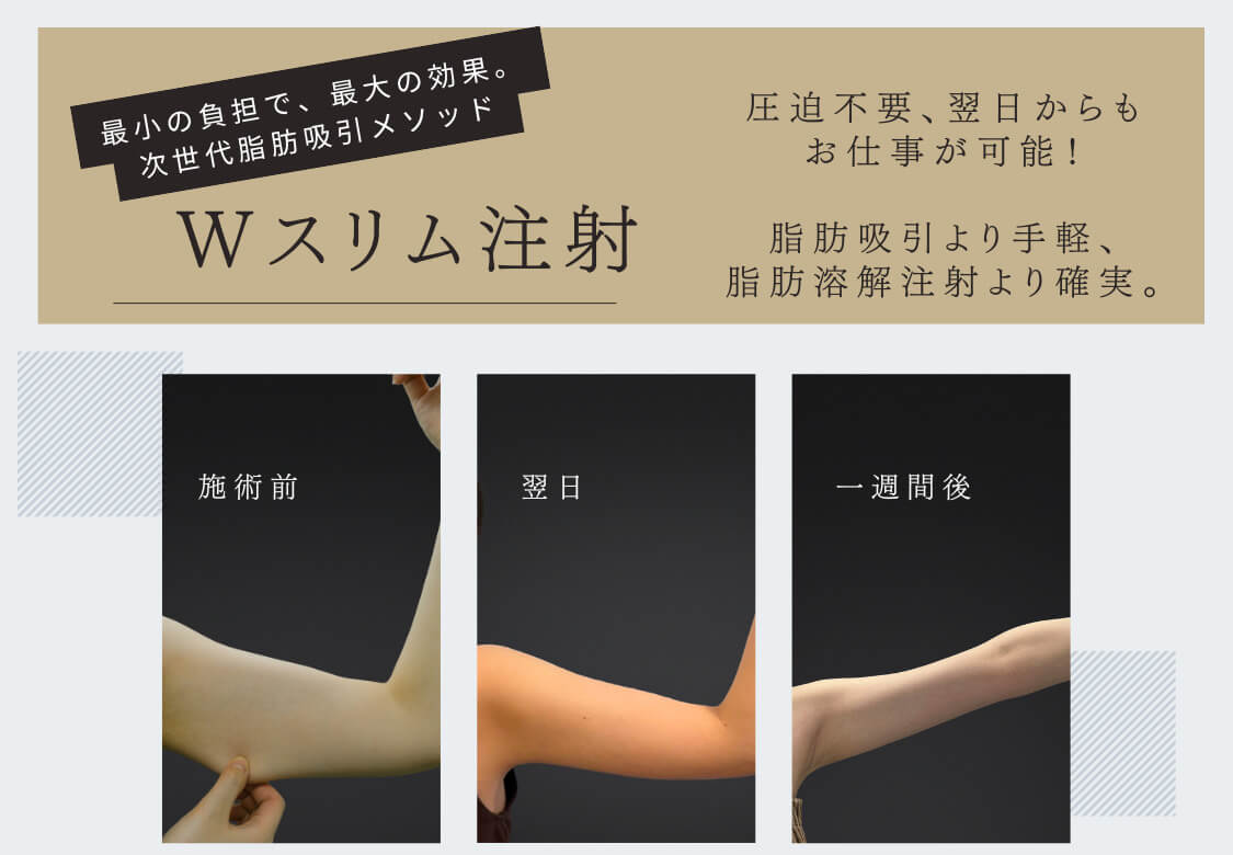 Wスリム注射