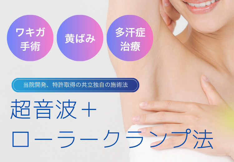 ローラークランプ